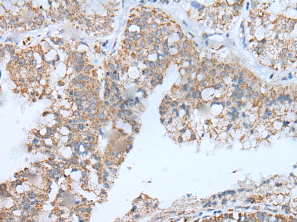 IGF2BP3