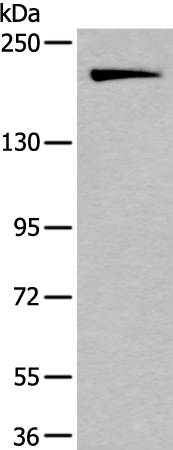 IQGAP1