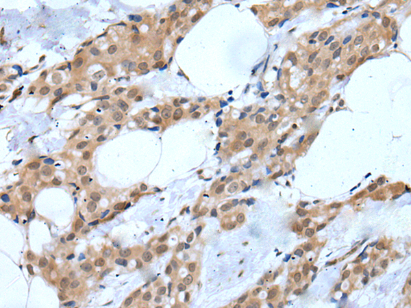 Rabbit Polyclonal Antibody to MTA3
