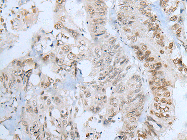 ZNF143