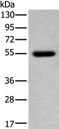 CDK14