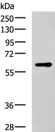 SLC17A8