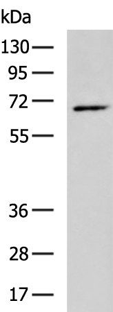 UBQLN2