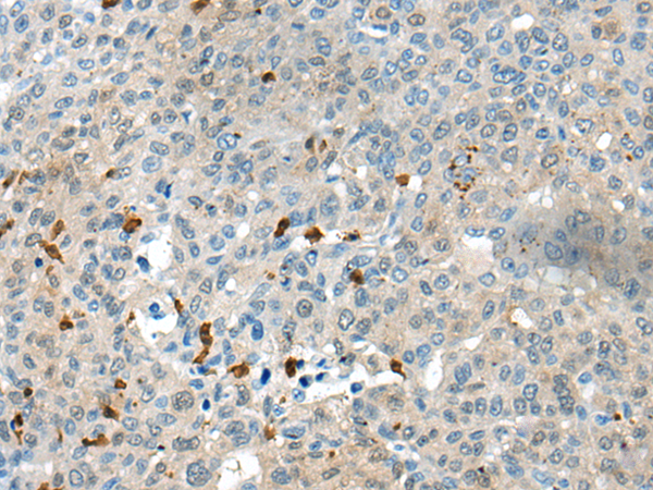 CELF4