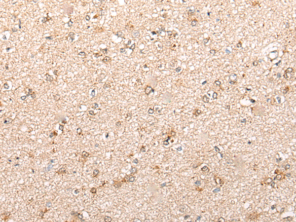 Rabbit Polyclonal Antibody to CYP11B2