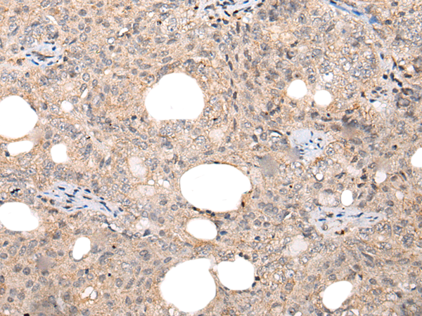 Rabbit Polyclonal Antibody to CHAMP1