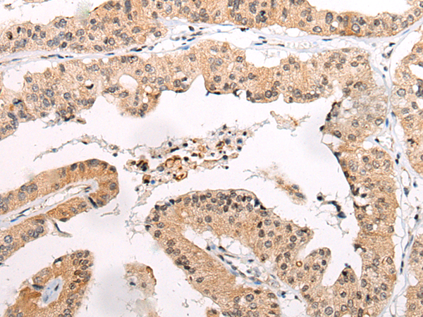 Rabbit Polyclonal Antibody to CHAMP1
