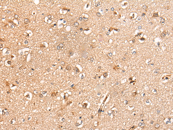 Rabbit Polyclonal Antibody to KLHL36