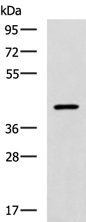 ADORA2A