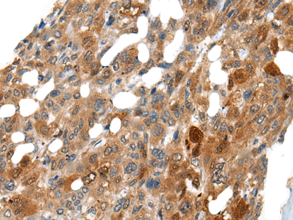 DNASE1L2