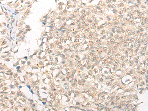 CPSF2