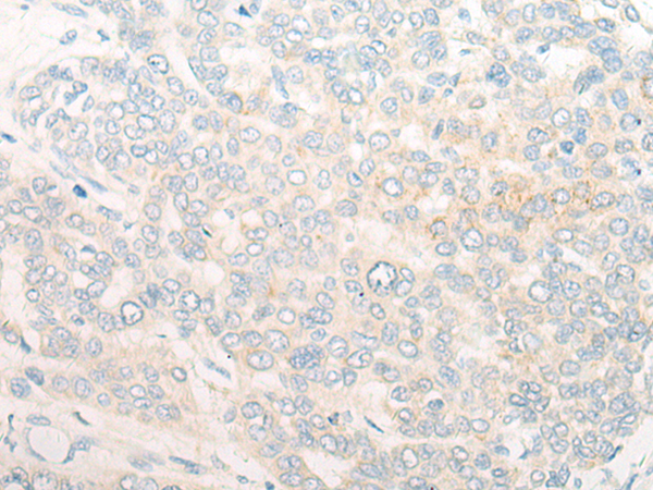 RNF19A