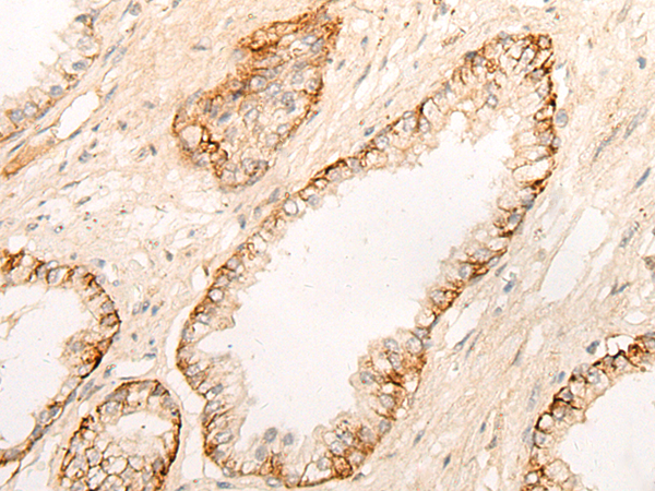 DPP9