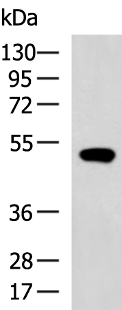 SLC29A2