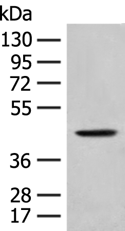 HLA-B