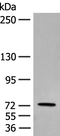 ESRP2