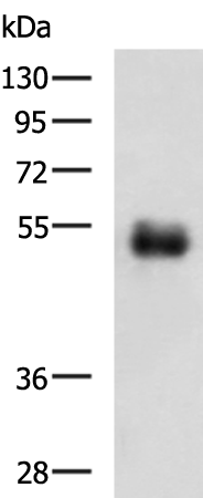 METTL17