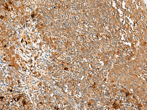 Rabbit Polyclonal Antibody to METTL17