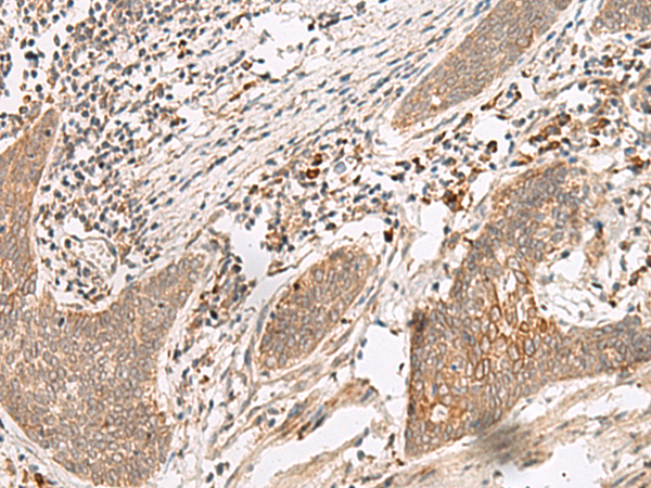 Rabbit Polyclonal Antibody to FUT10