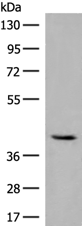 GBGT1