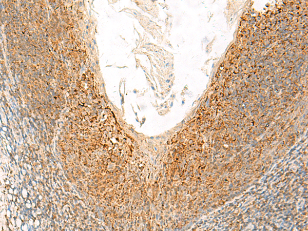 Rabbit Polyclonal Antibody to GLUD1