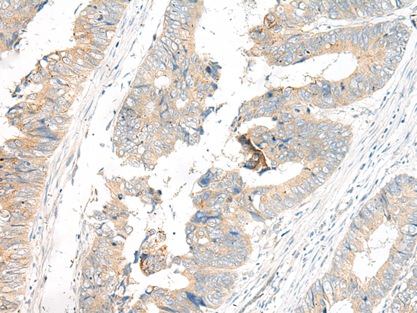 Rabbit Polyclonal Antibody to GP6