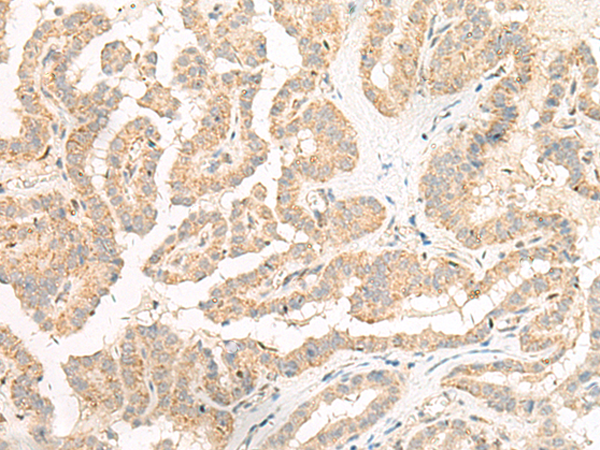 Rabbit Polyclonal Antibody to GP6