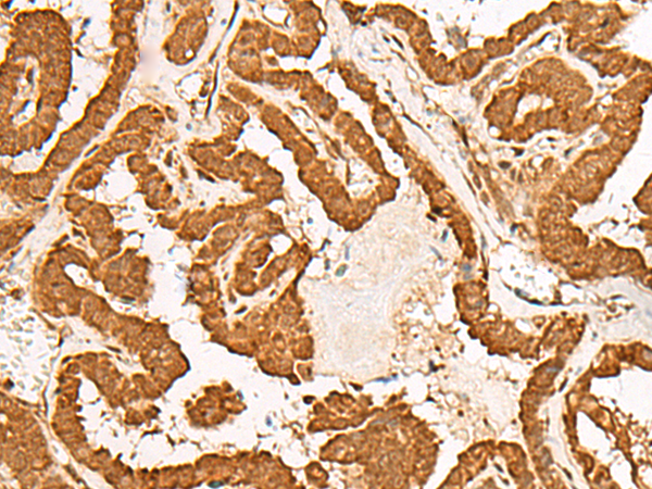 Rabbit Polyclonal Antibody to GMEB2