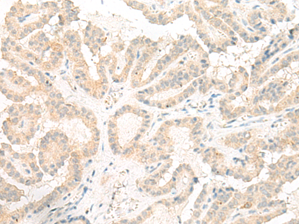 Rabbit Polyclonal Antibody to GOLGA5