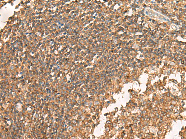 GPSM2