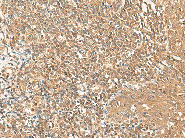 GRIPAP1