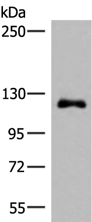 ARHGAP45