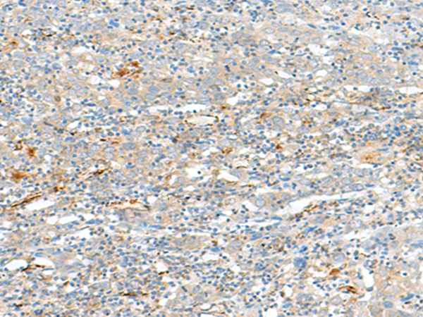 HLA-DQA2