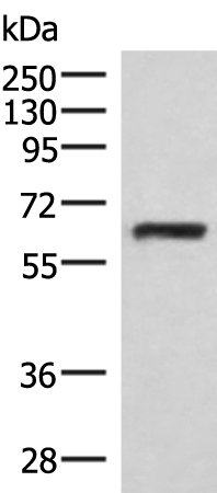 RNF217