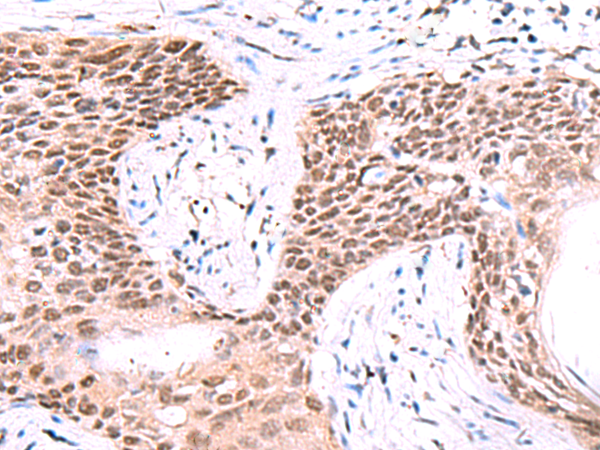 IRF2BP1