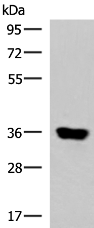 KCNK15