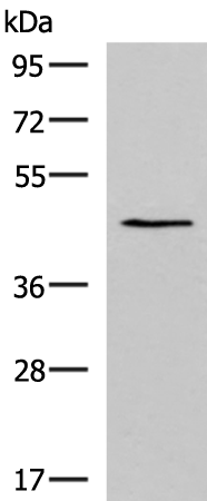 KCNK18