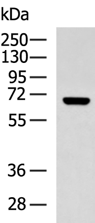 KCNN2