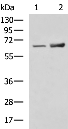 SLC28A1