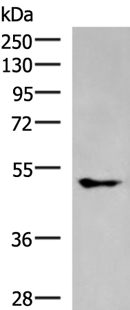 KCNJ2