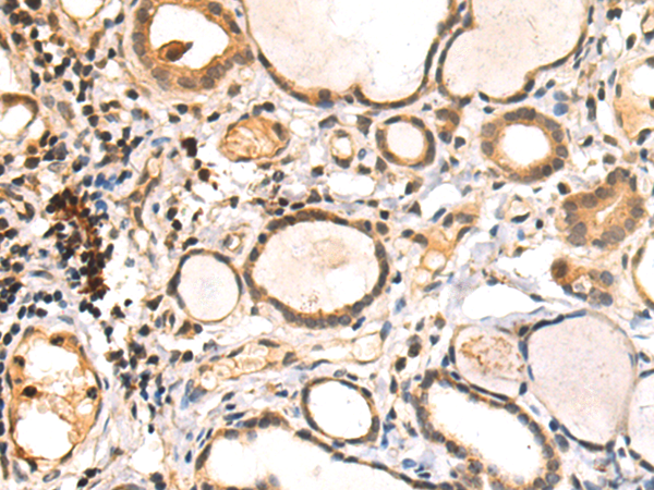 HDAC9
