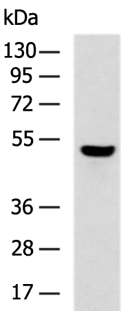 CYP24A1