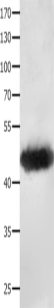 MAT1A