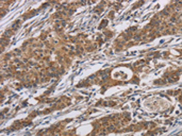 Rabbit Polyclonal Antibody to AGER