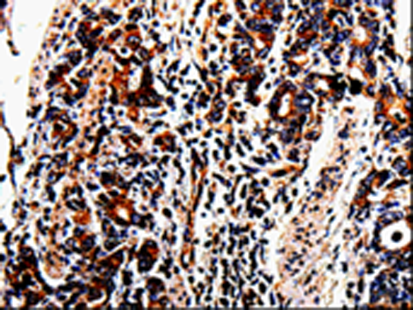 ACSBG2