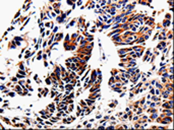 Rabbit Polyclonal Antibody to ACSBG2