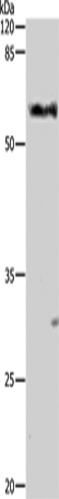 ALDH1A1/ALDH1A2/ALDH1A3