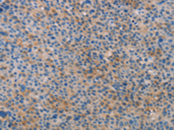 ALOX15B