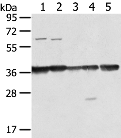 ANXA2