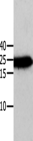 ANXA5